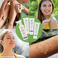 Forever Summer Kit med Aloe Scrub, Aloe Moisturizing Lotion, Aloe First og Aloe Vera Gelly