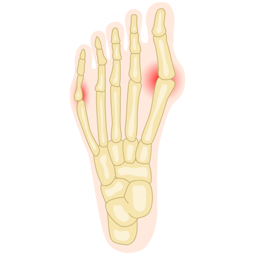Sådan stilles diagnosen