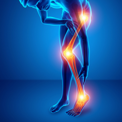 Hælen i et helhedsperspektiv